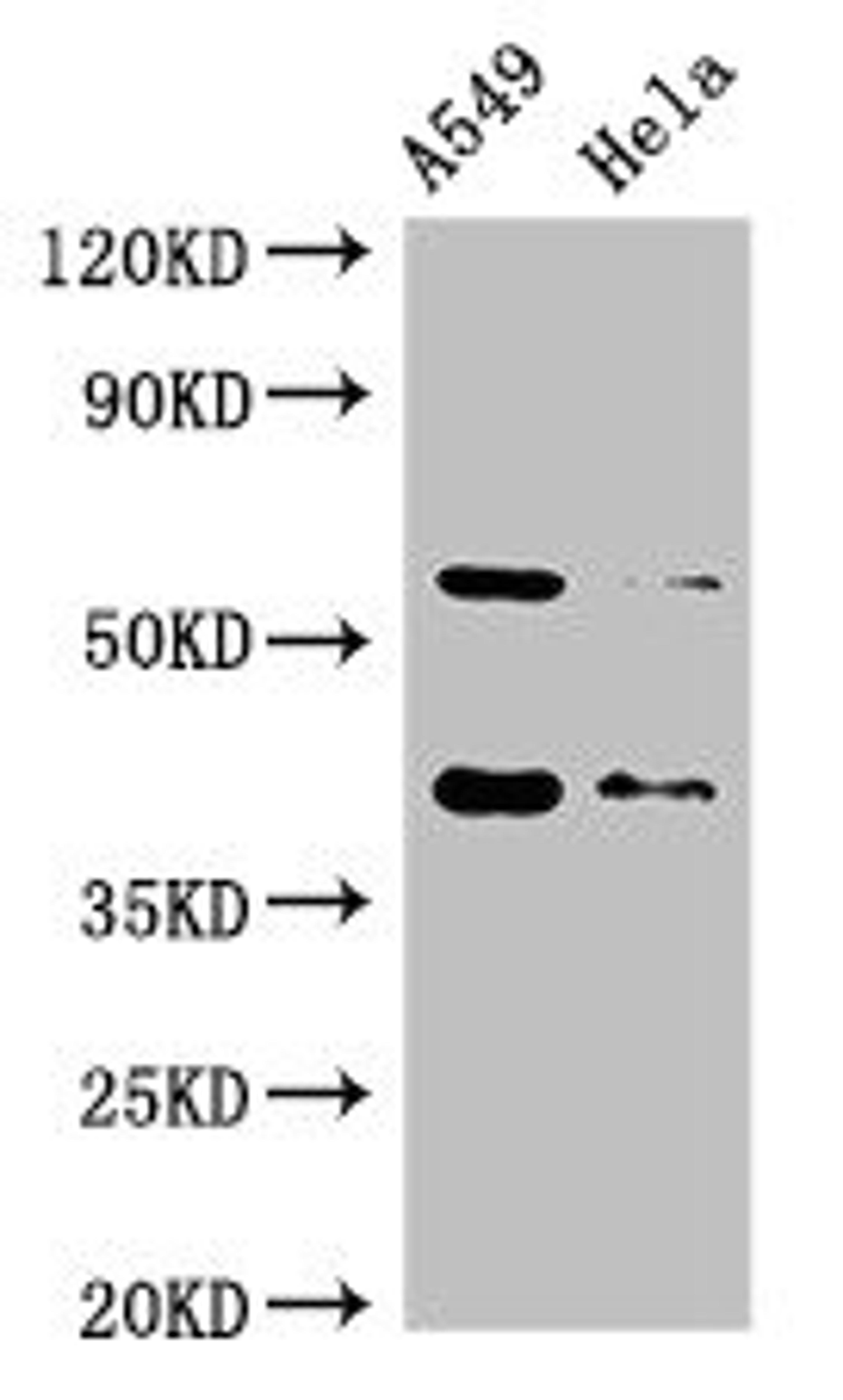 Western Blot. Positive WB detected in: A549 whole cell lysate, Hela whole cell lysate. All lanes: SMN1 antibody at 2µg/ml. Secondary. Goat polyclonal to rabbit IgG at 1/50000 dilution. Predicted band size: 32, 29, 31, 28 kDa. Observed band size: 40, 60 kDa