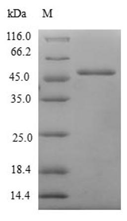 (Tris-Glycine gel) Discontinuous SDS-PAGE (reduced) with 5% enrichment gel and 15% separation gel.