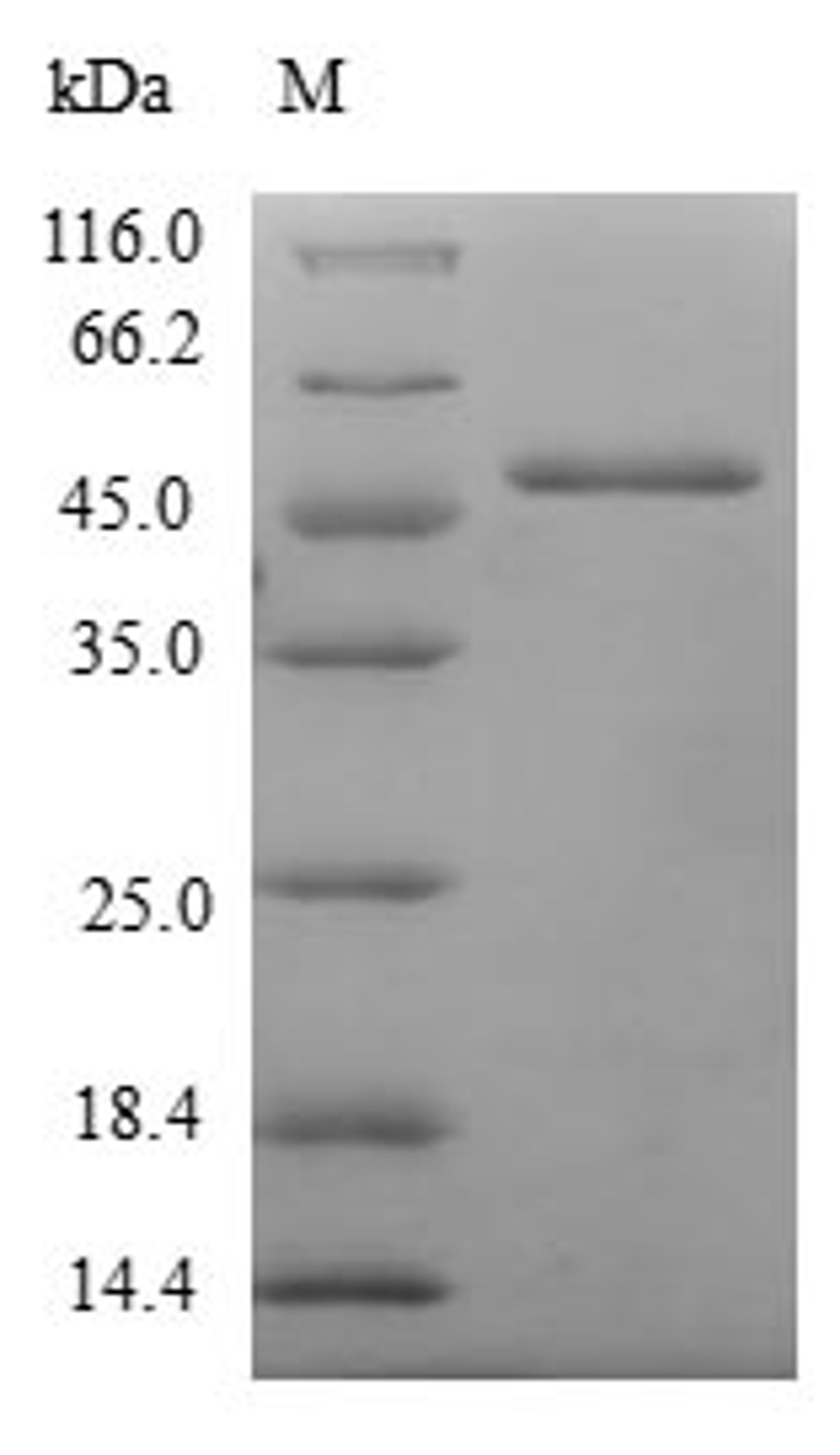 (Tris-Glycine gel) Discontinuous SDS-PAGE (reduced) with 5% enrichment gel and 15% separation gel.