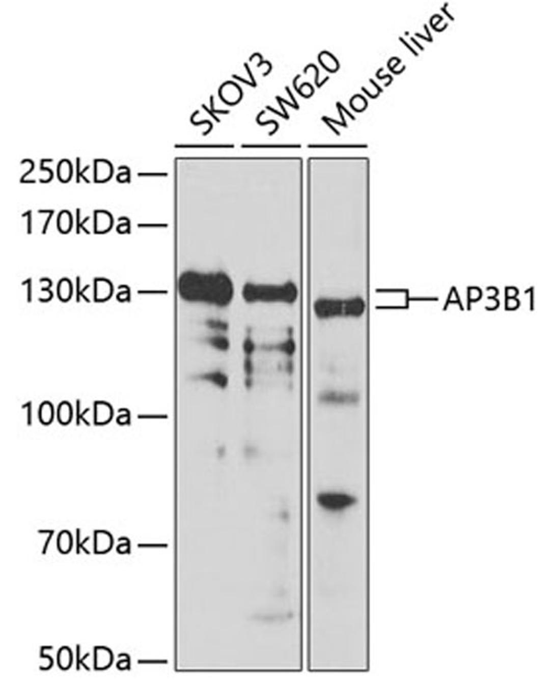 Western blot - AP3B1 antibody (A7019)