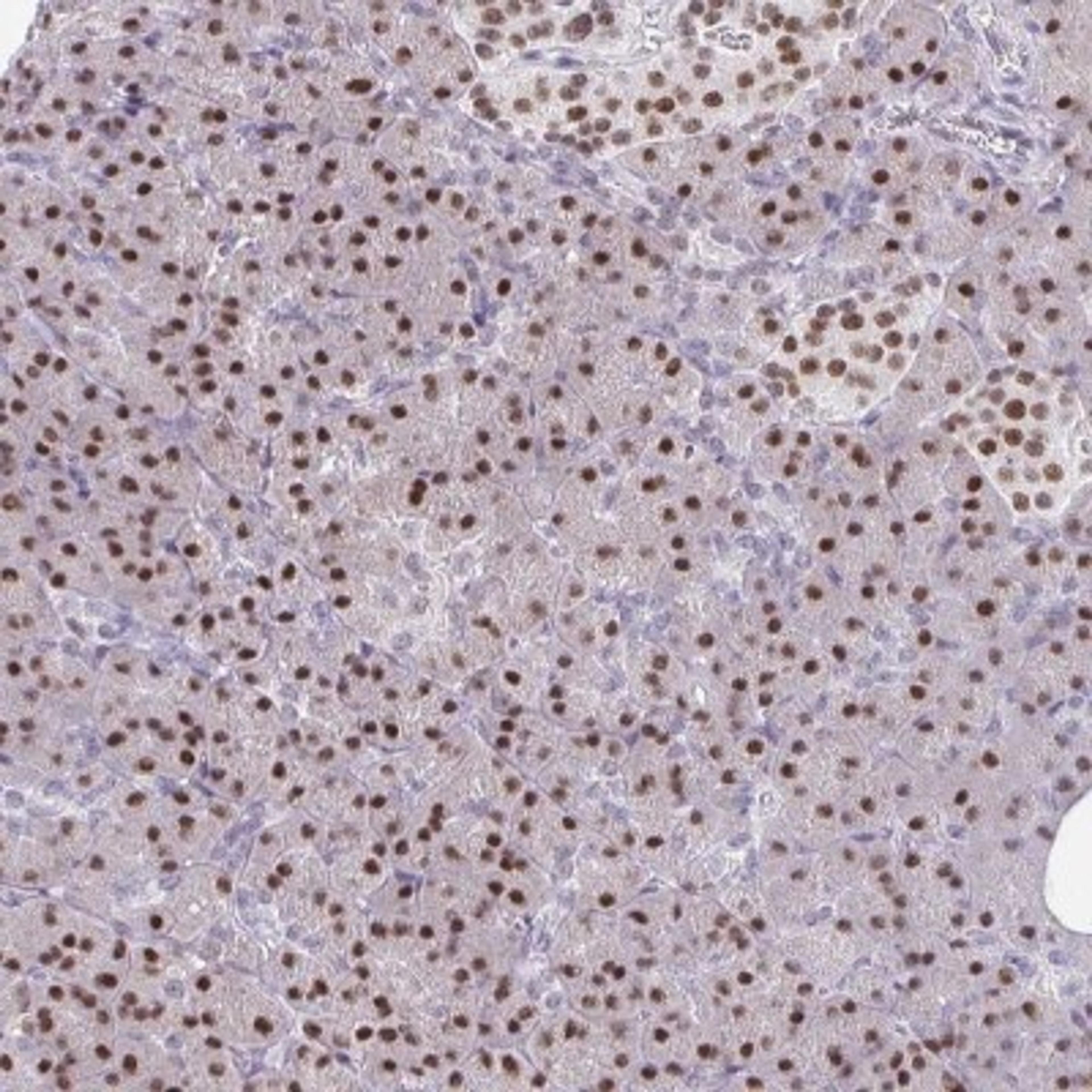 Immunohistochemistry: PLK3 Antibody [NBP2-32530] - Staining of human pancreas shows strong nuclear positivity in exocrine glandular cells.