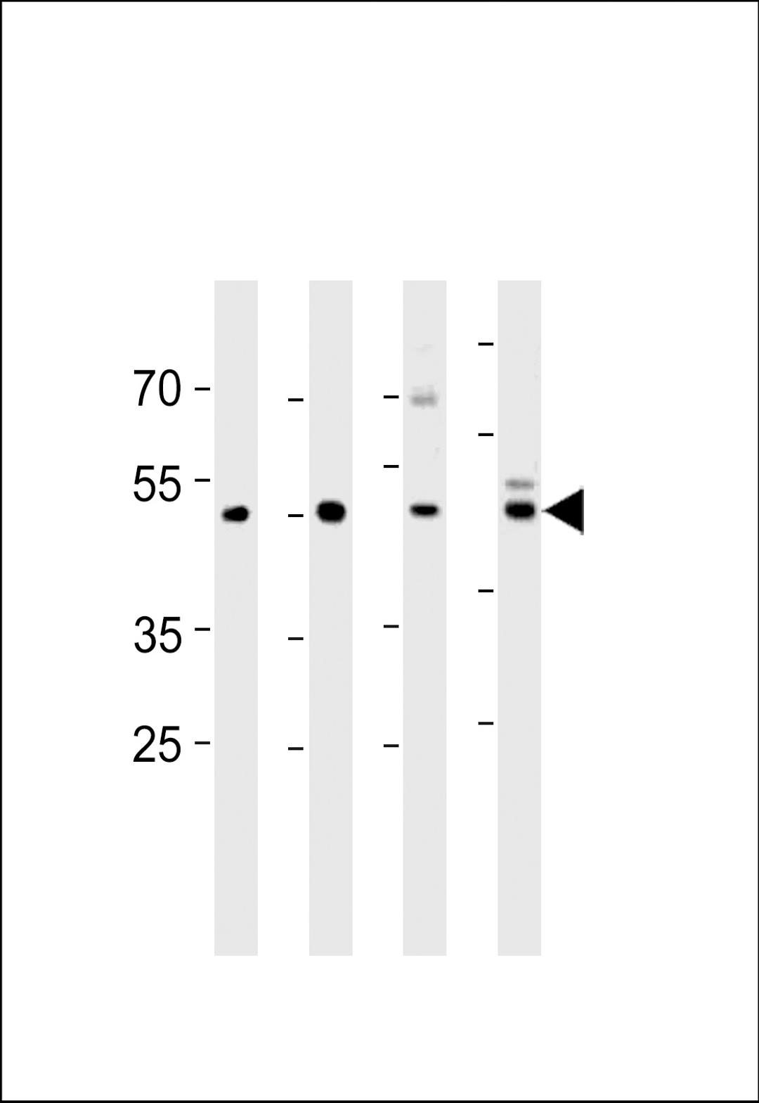 Western blot analysis in U251,mouse C2C12,mouse NIH/3T3 cell line and mouse brain tissue lysates (35ug/lane).