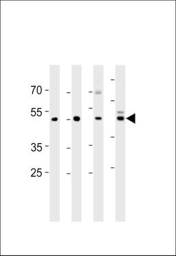 Western blot analysis in U251,mouse C2C12,mouse NIH/3T3 cell line and mouse brain tissue lysates (35ug/lane).