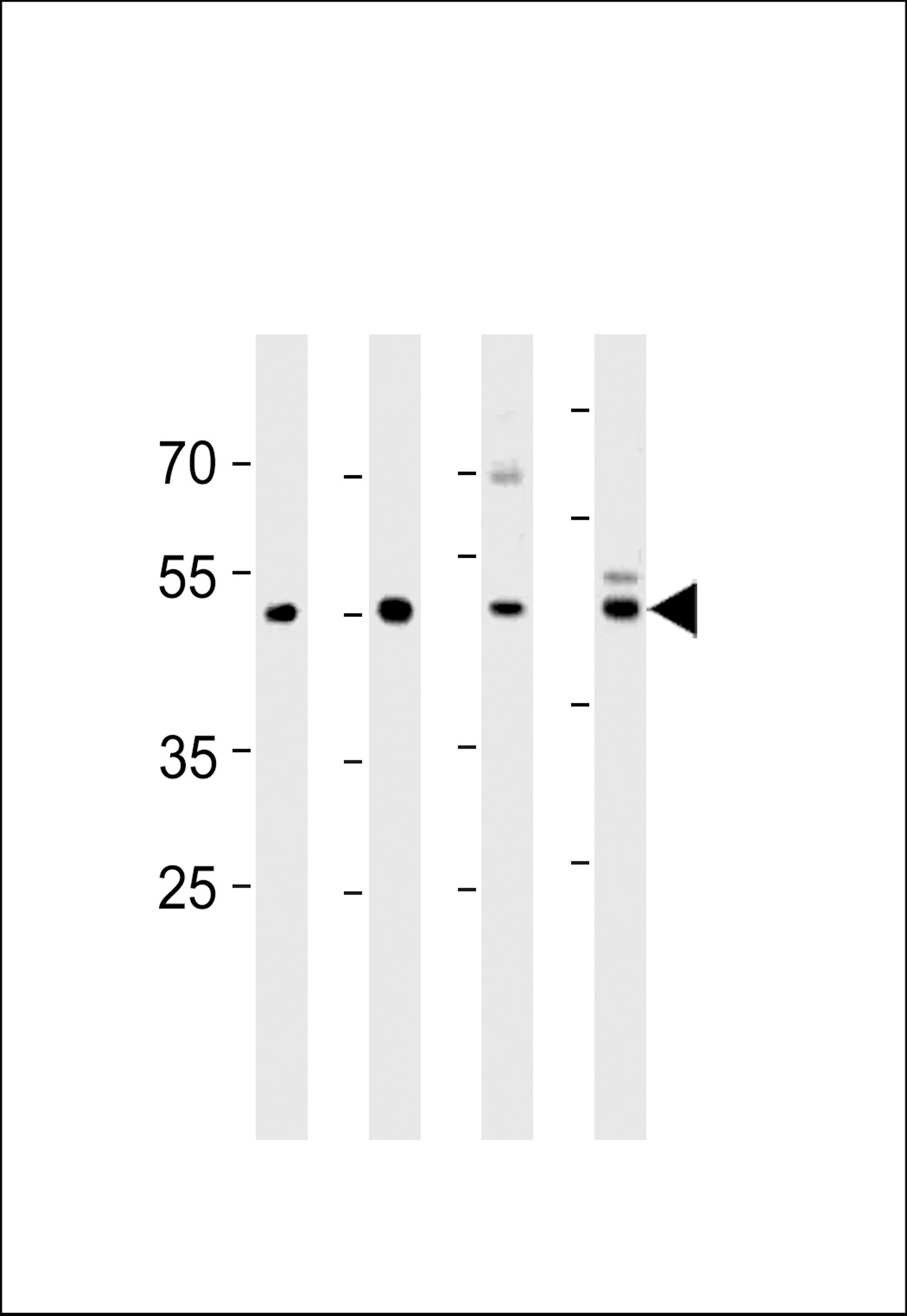 Western blot analysis in U251,mouse C2C12,mouse NIH/3T3 cell line and mouse brain tissue lysates (35ug/lane).