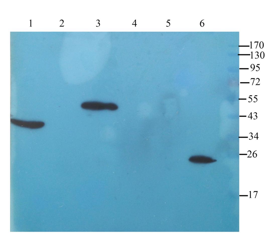 WB analysis of rat liver (lane 1), mouse heart (lane 2), rat colon (lane 3), mouse spleen (lane 4), mouse kidney (lane 5), rat testis (lane 6) using IL11 antibody (1 ug/ml)