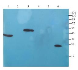 WB analysis of rat liver (lane 1), mouse heart (lane 2), rat colon (lane 3), mouse spleen (lane 4), mouse kidney (lane 5), rat testis (lane 6) using IL11 antibody (1 ug/ml)