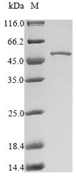 (Tris-Glycine gel) Discontinuous SDS-PAGE (reduced) with 5% enrichment gel and 15% separation gel.