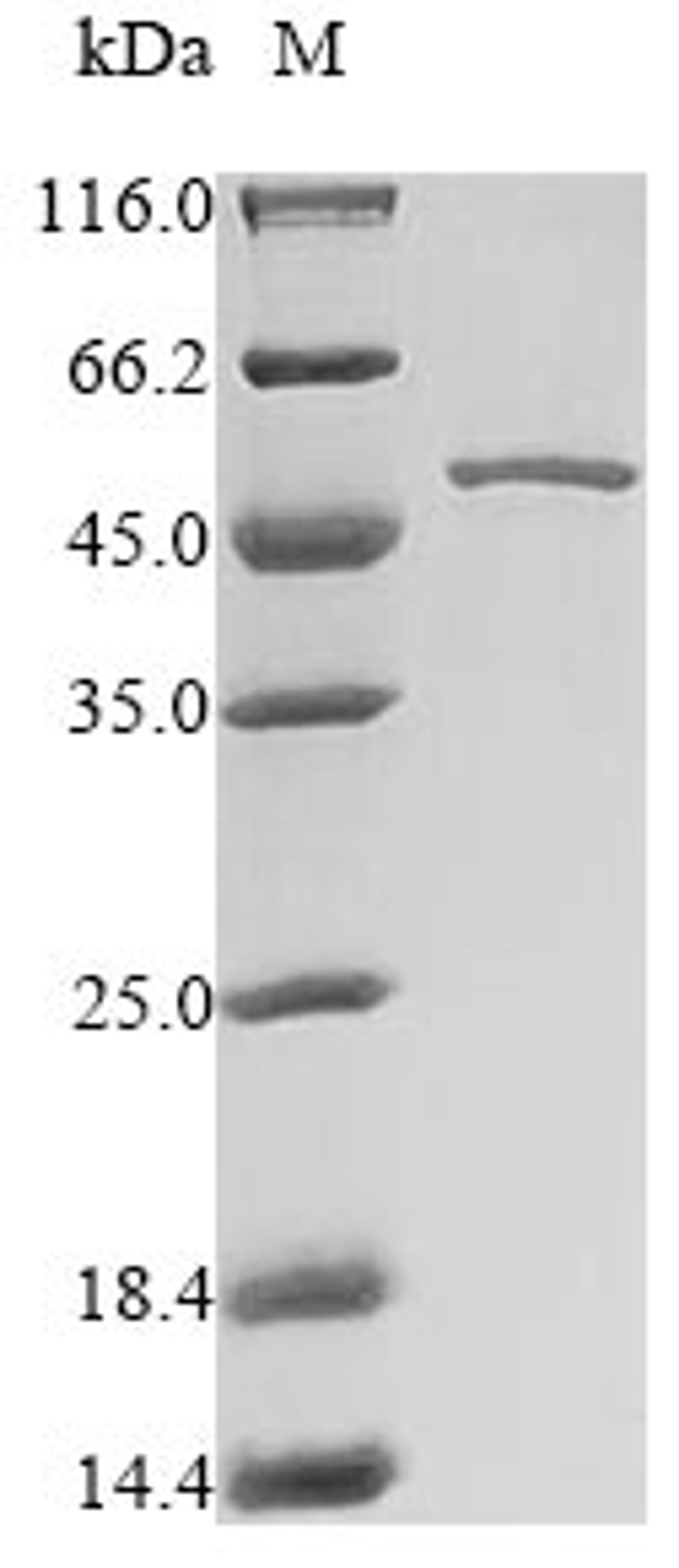 (Tris-Glycine gel) Discontinuous SDS-PAGE (reduced) with 5% enrichment gel and 15% separation gel.
