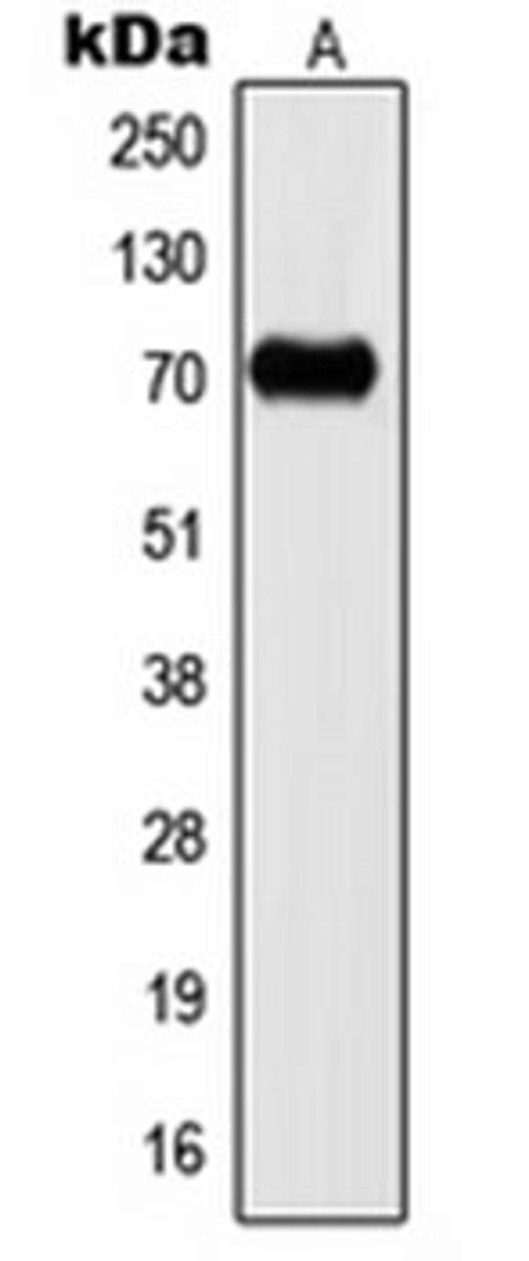 Western blot analysis of U251MG (Lane 1) whole cell lysates using KCNC2 antibody