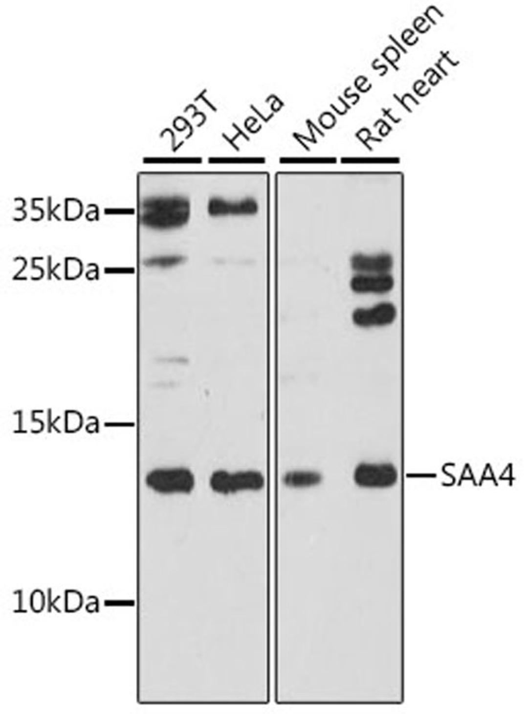 Western blot - SAA4 antibody (A16428)