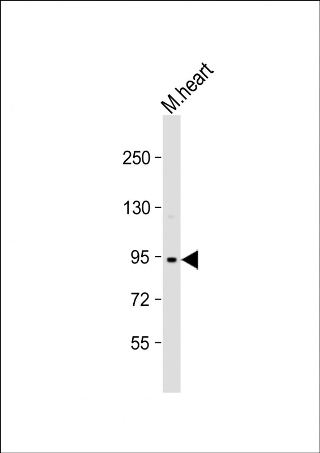 Western Blot at 1:1000 dilution + mouse heart lysate Lysates/proteins at 20 ug per lane.