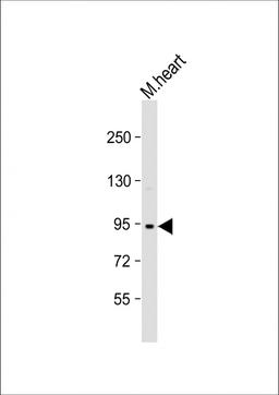 Western Blot at 1:1000 dilution + mouse heart lysate Lysates/proteins at 20 ug per lane.