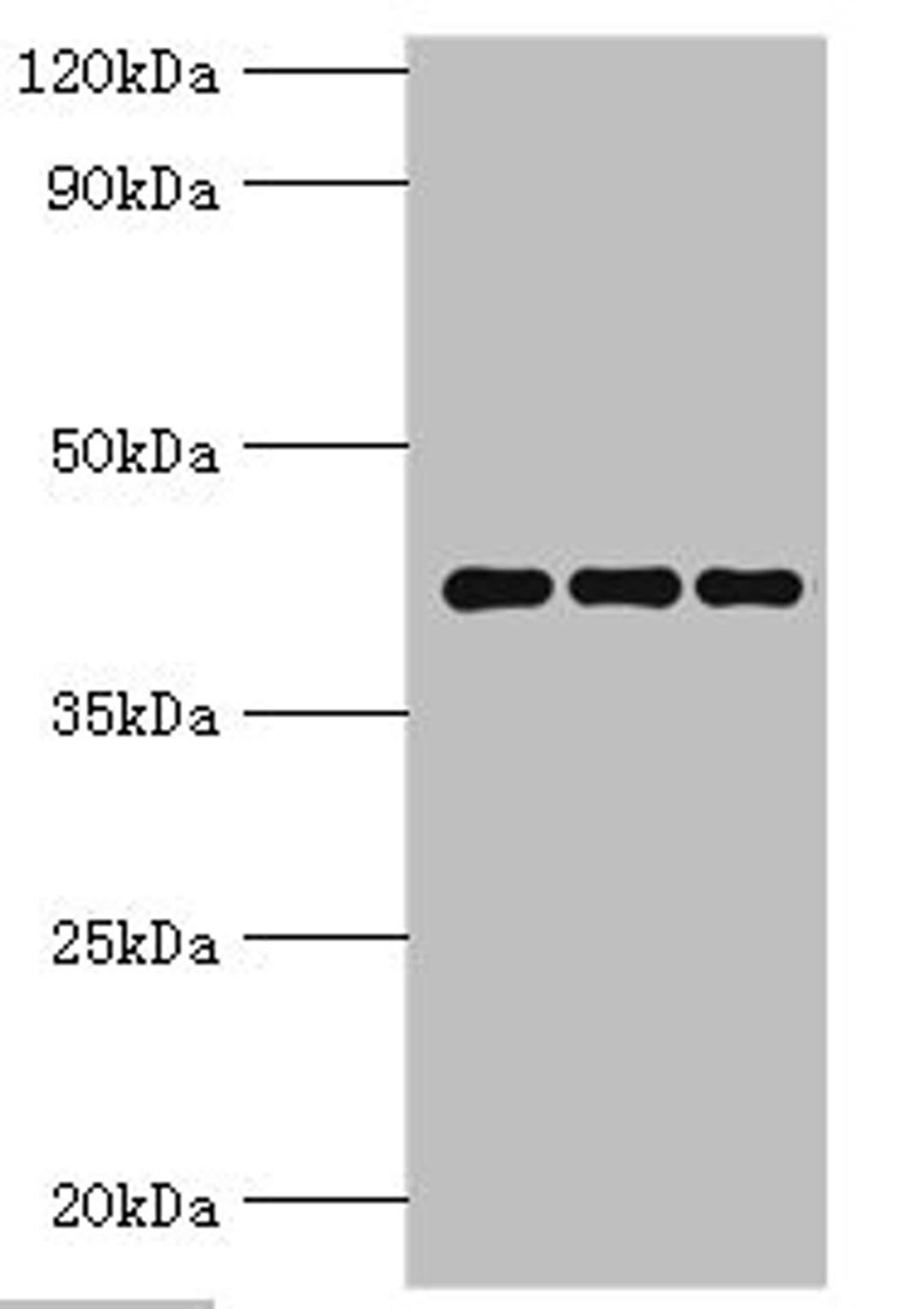 Western blot. All lanes: Peptidyl-prolyl cis-trans isomerase D antibody at 9ug/ml. Lane 1: Mouse brain tissue. Lane 2: A549 whole cell lysate. Lane 3: MCF-7 whole cell lysate. Secondary. Goat polyclonal to rabbit IgG at 1/10000 dilution. Predicted band size: 41 kDa. Observed band size: 41 kDa. 