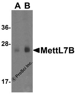 Western blot analysis of MettL7B in human colon tissue lysate with MettL7B antibody at (A) 1 and (B) 2 μg/mL.