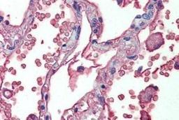 Immunohistochemistry-Paraffin: Human Serum Albumin Antibody (2H3D1;8F6F9) [NBP1-52414] - Analysis of anti-Serum Albumin antibody with human lung at dilution 1:200.