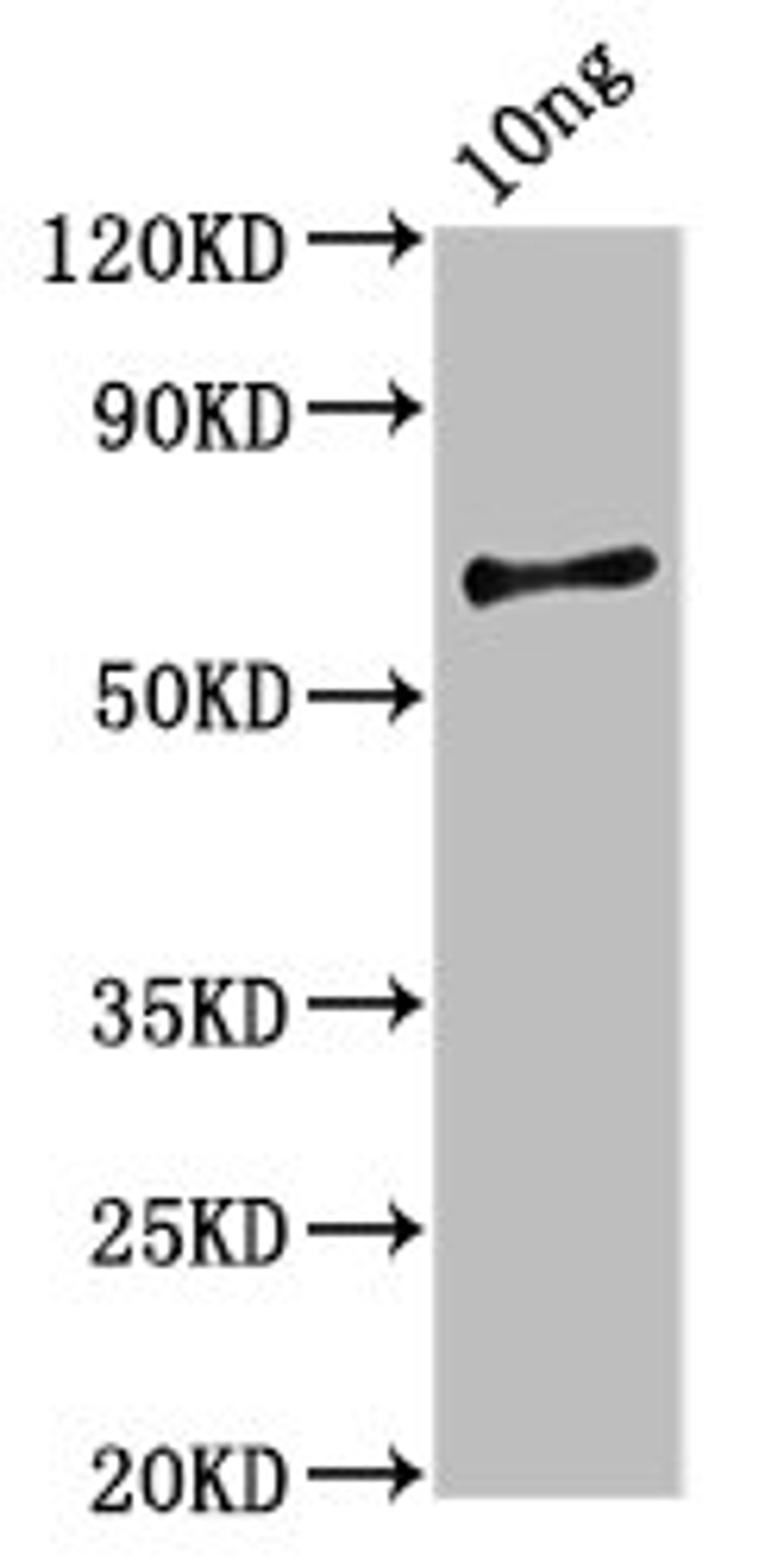 Western Blot. Positive WB detected in Recombinant protein. All lanes: vvhA antibody at 2.3ug/ml. Secondary. Goat polyclonal to rabbit IgG at 1/50000 dilution. Predicted band size: 58 kDa. Observed band size: 58 kDa. 