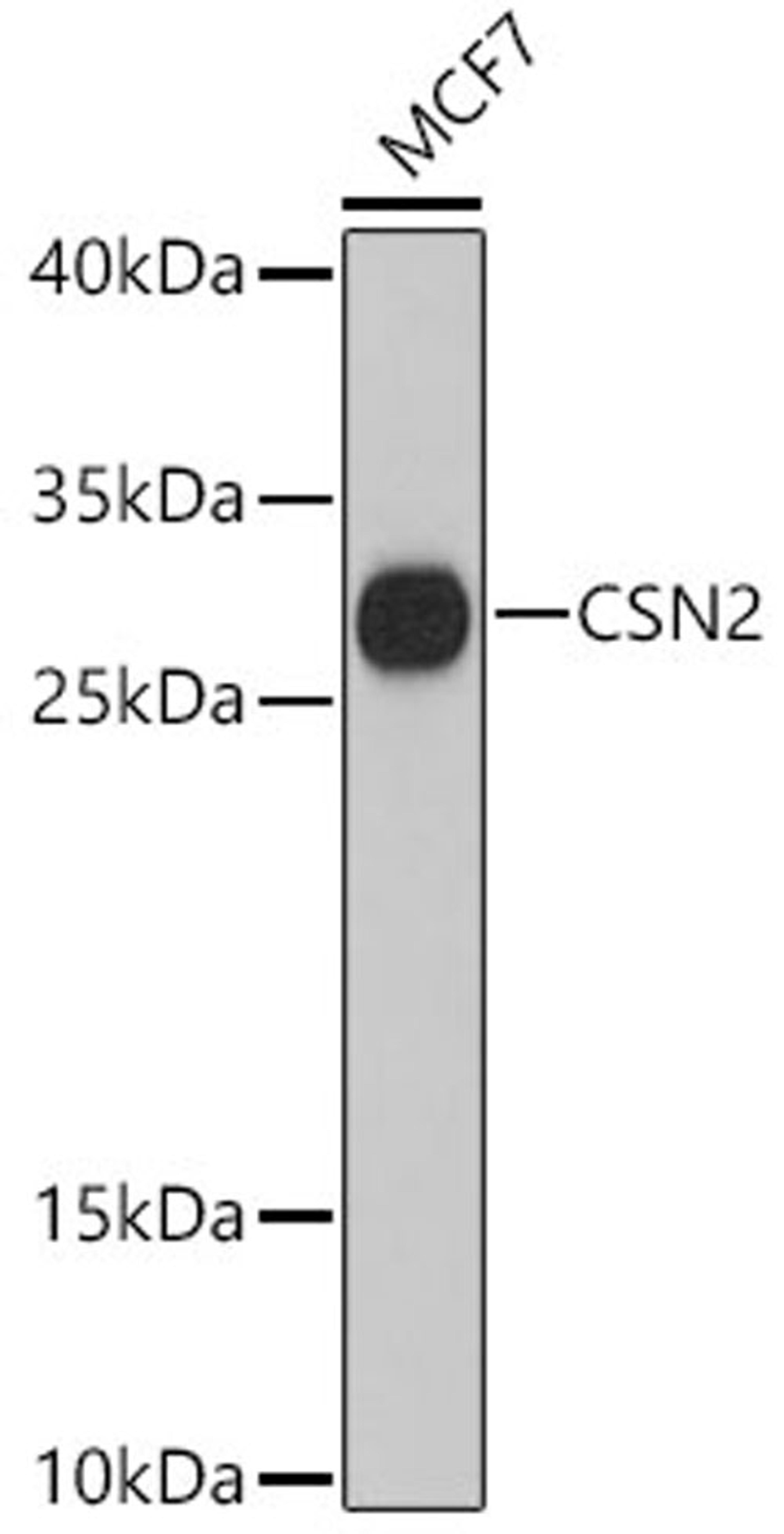 Western blot - CSN2 antibody (A12749)