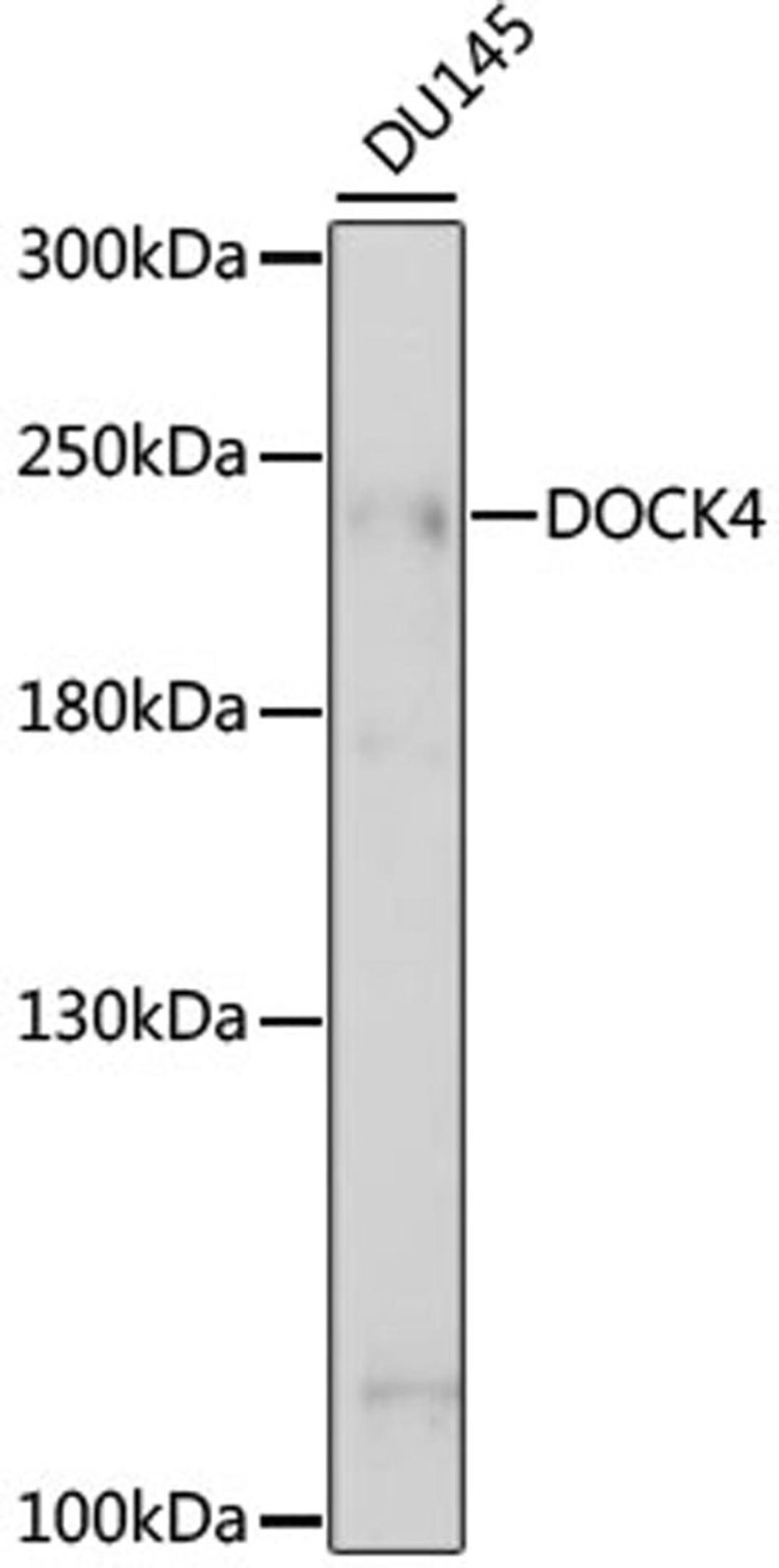 Western blot - DOCK4 antibody (A15764)