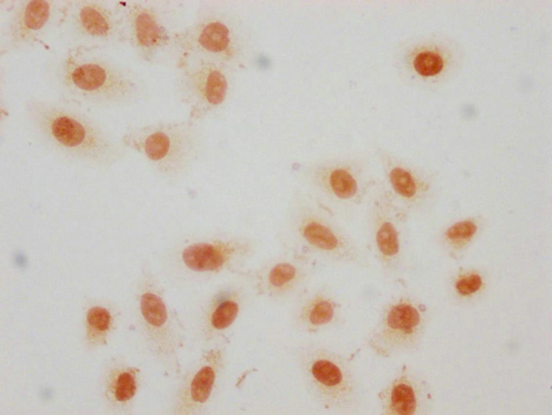 Immunocytochemistry analysis of CSB-PA010389OA36crHU diluted at 1:50 and staining in Hela cells(treated with 30mM sodium crotonylate for 4h) performed on a Leica BondTM system. The cells were fixed in 4% formaldehyde, permeabilized using 0.2% Triton X-100 and blocked with 10% normal goat serum 30min at RT. Then primary antibody (1% BSA) was incubated at 4°C overnight. The primary is detected by a biotinylated secondary antibody and visualized using an HRP conjugated SP system.