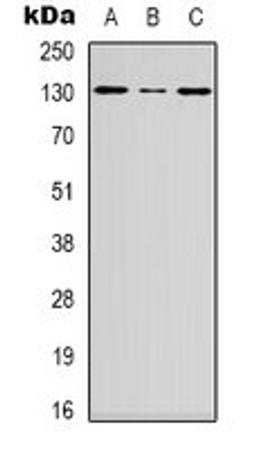 Western blot analysis of HEK293T (Lane 1), Hela (Lane 2), mouse brain (Lane 3) whole cell lysates using DGK iota antibody