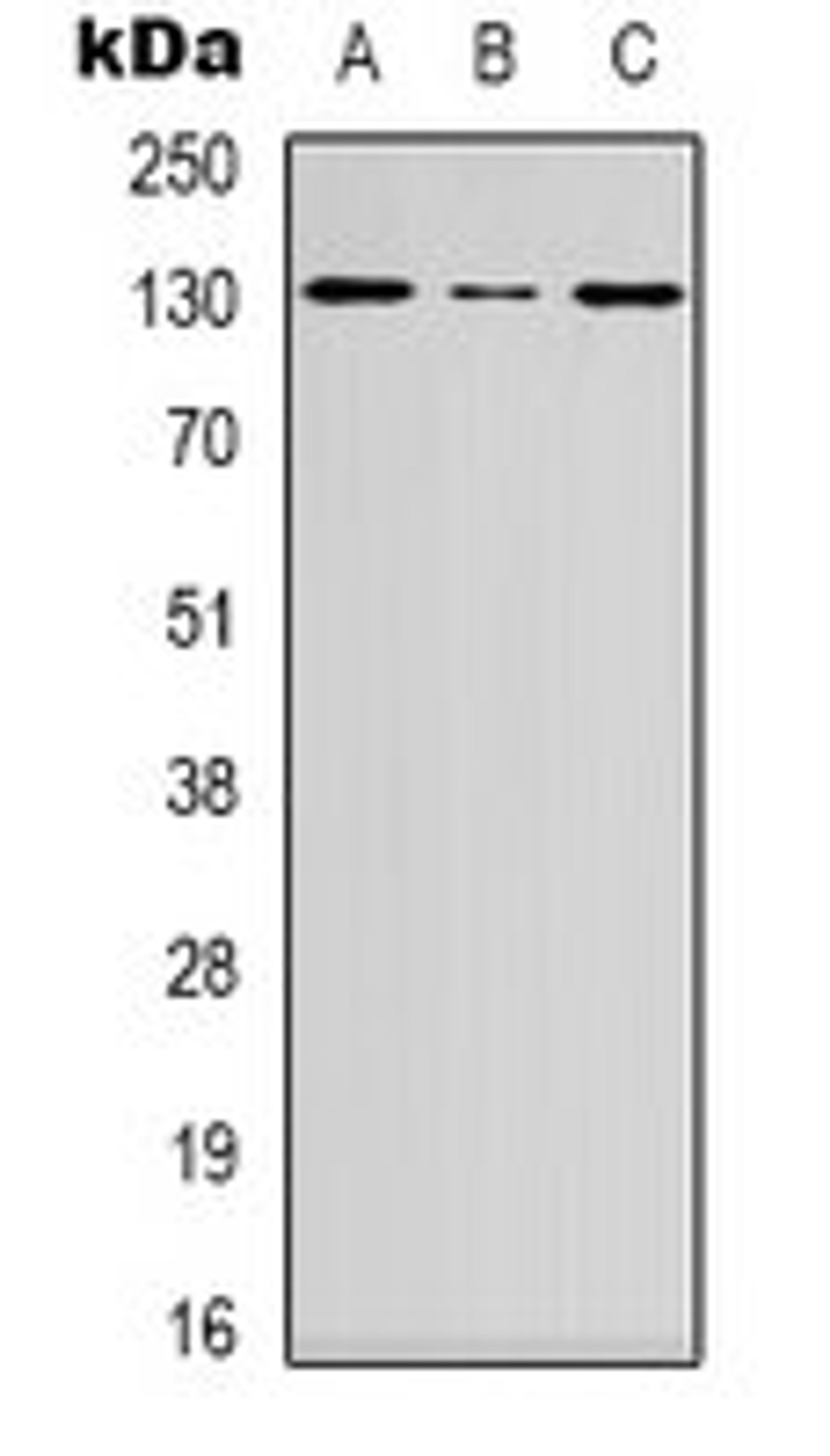 Western blot analysis of HEK293T (Lane 1), Hela (Lane 2), mouse brain (Lane 3) whole cell lysates using DGK iota antibody