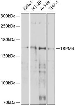 Western blot - TRPM4 antibody (A10146)