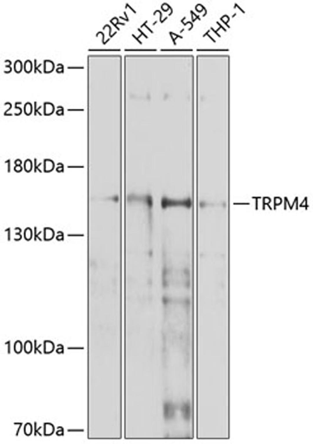 Western blot - TRPM4 antibody (A10146)