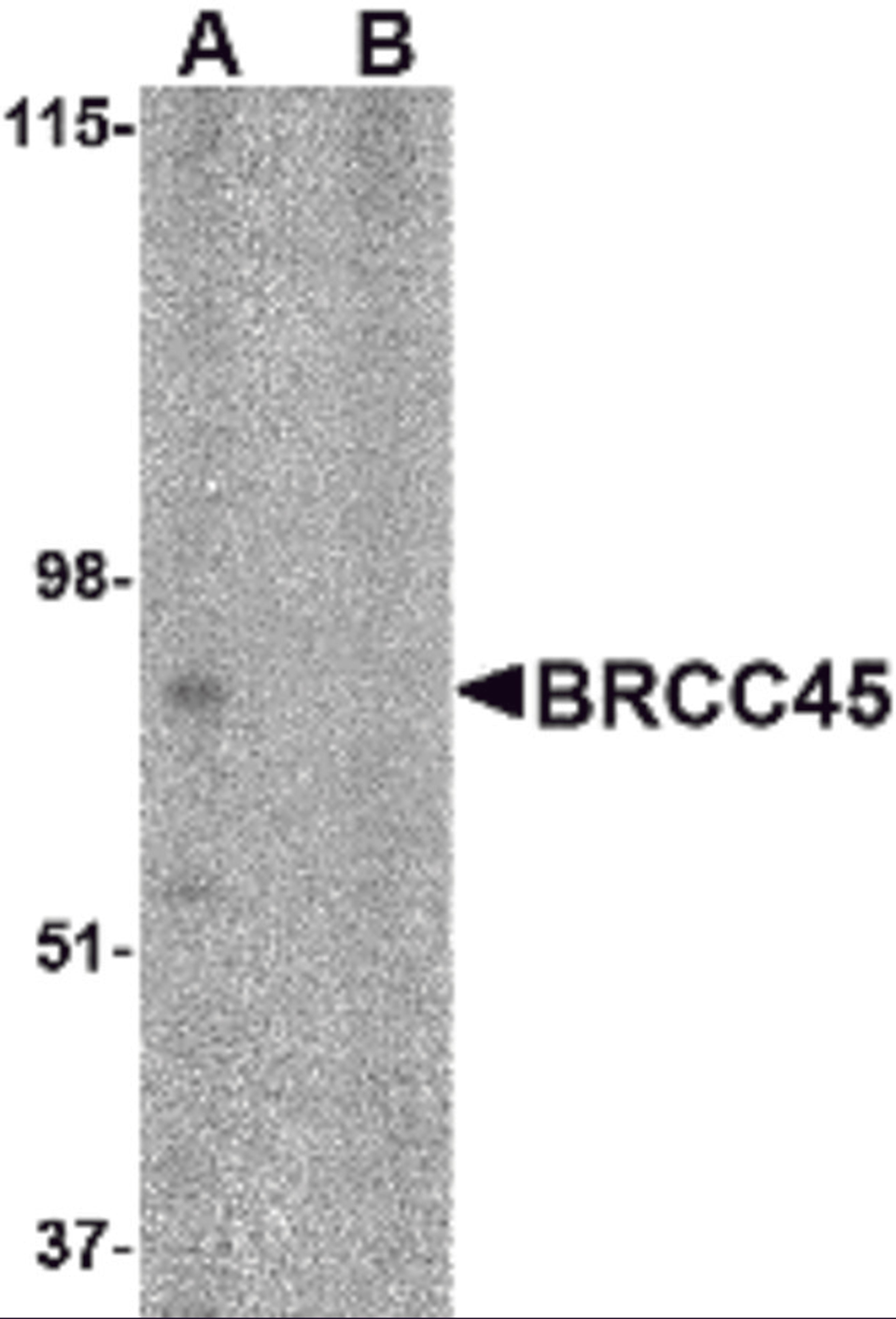 Western blot analysis of BRCC45 in HeLa cell lysate in (A) the absence and (B) presence of blocking peptide with BRCC45 antibody at 1 &#956;g/mL.