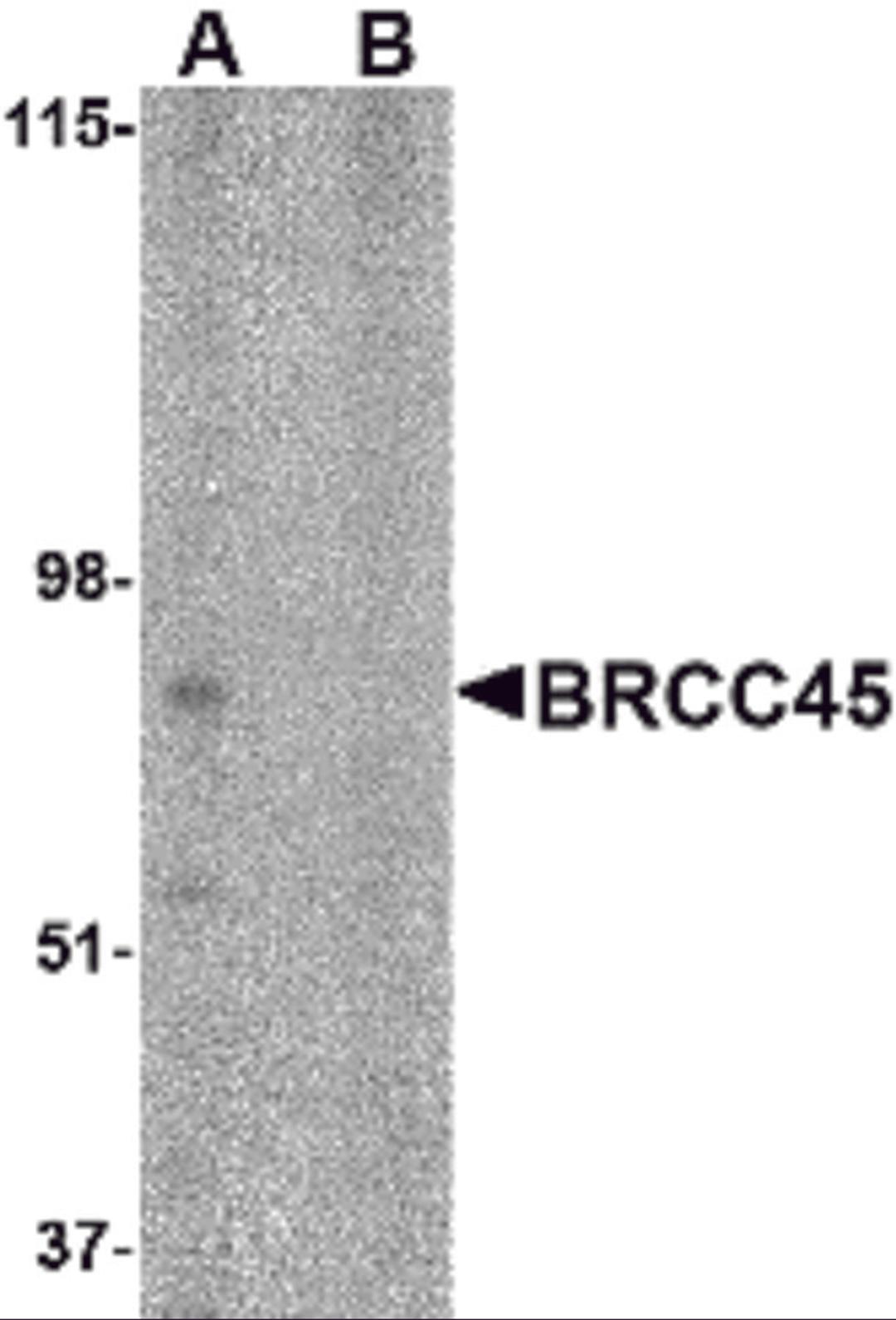 Western blot analysis of BRCC45 in HeLa cell lysate in (A) the absence and (B) presence of blocking peptide with BRCC45 antibody at 1 μg/mL.