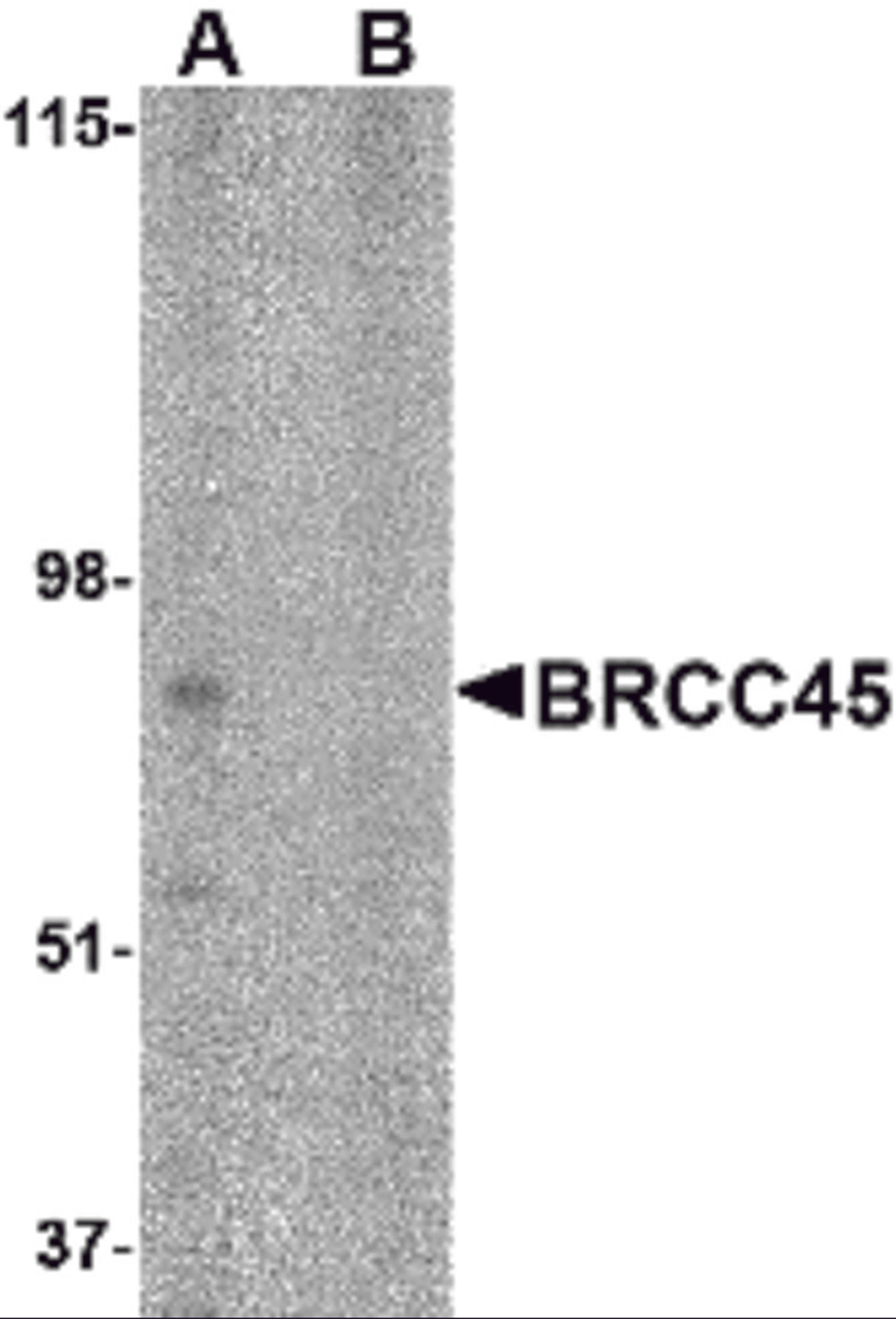 Western blot analysis of BRCC45 in HeLa cell lysate in (A) the absence and (B) presence of blocking peptide with BRCC45 antibody at 1 μg/mL.