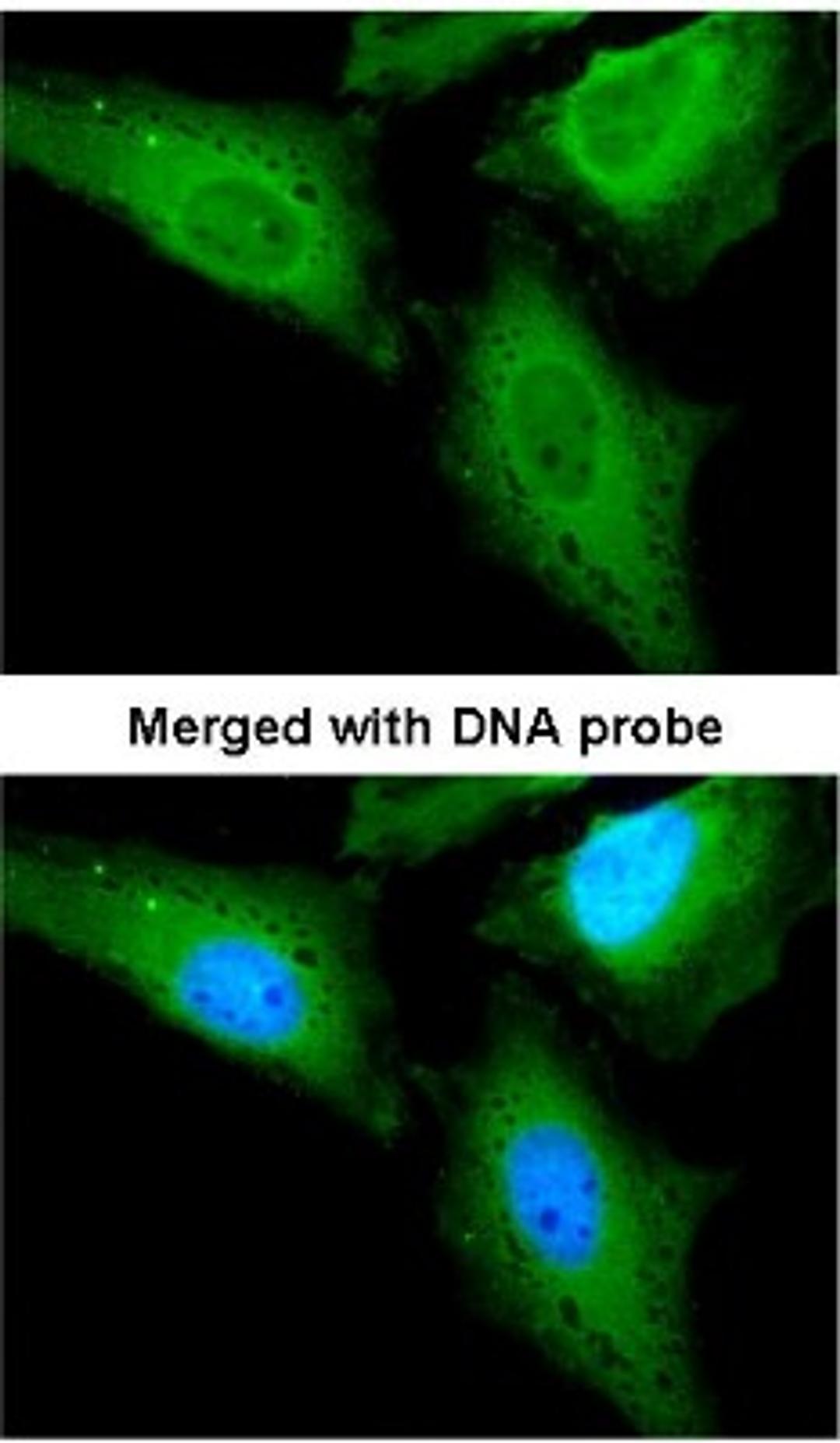 Immunocytochemistry/Immunofluorescence: CaMKK2 Antibody [NBP1-31247] - Analysis of HeLa, using CAMKK2 antibody at 1:200 dilution.