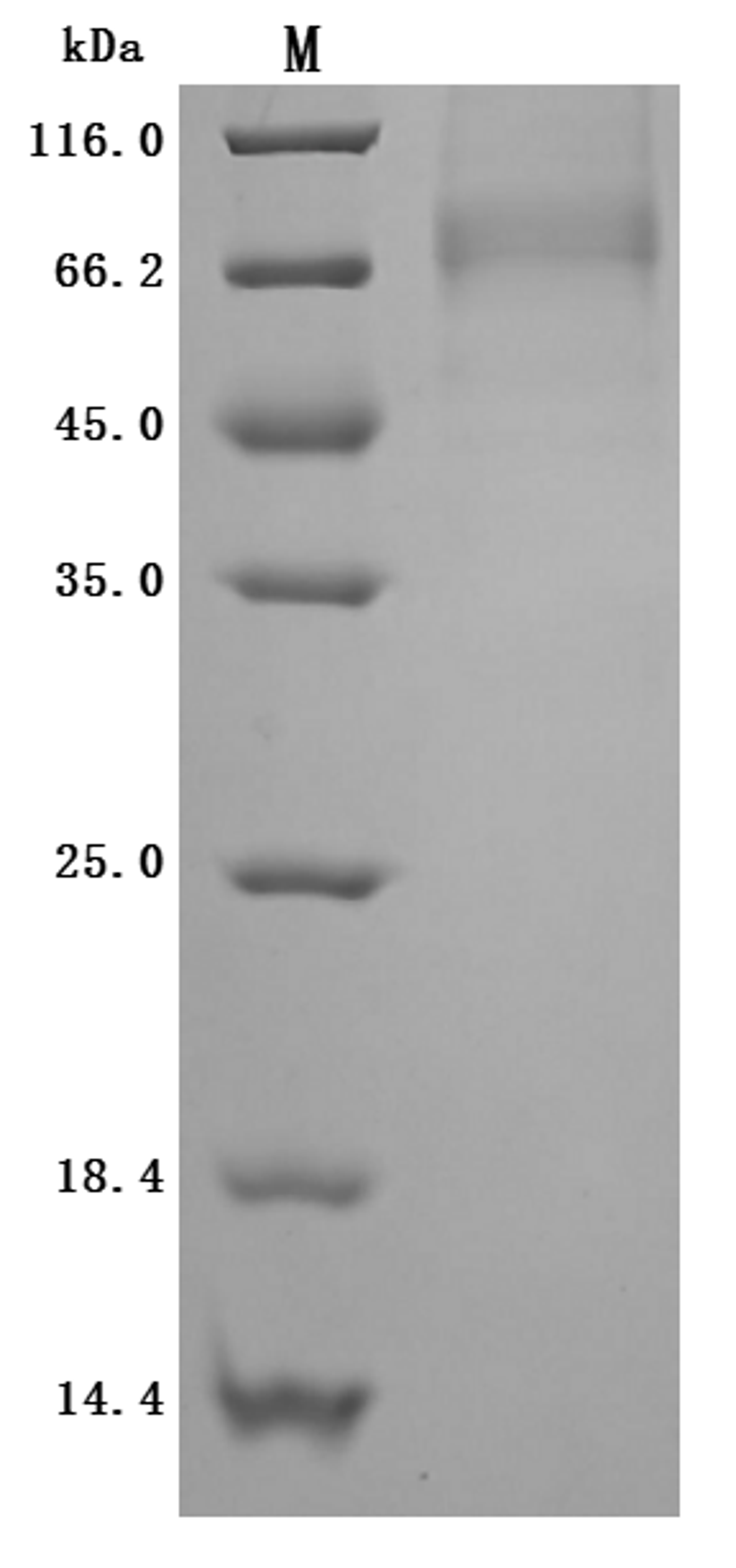 (Tris-Glycine gel) Discontinuous SDS-PAGE (reduced) with 5% enrichment gel and 15% separation gel.