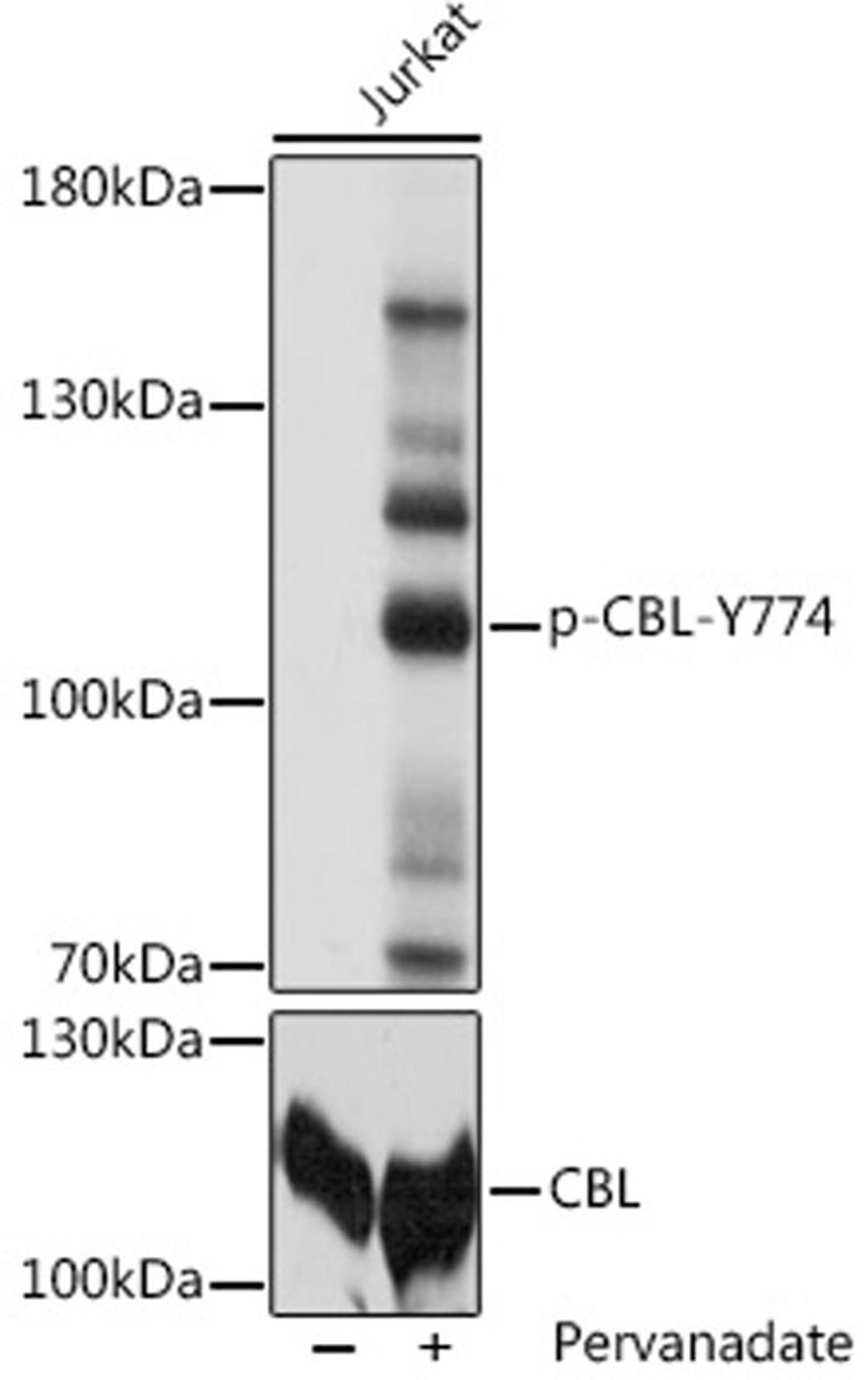 Western blot - Phospho-CBL-Y774 pAb (AP0794)