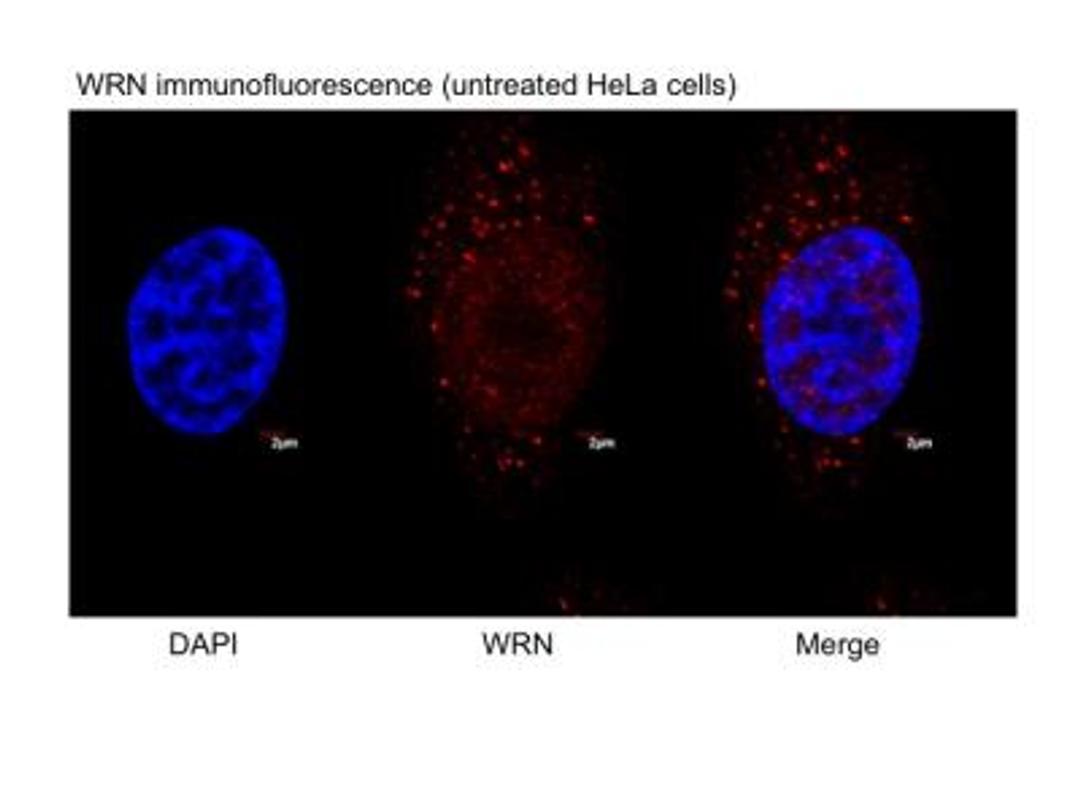 Immunocytochemistry/Immunofluorescence: WRN Antibody [NB100-471] - Analysis of WRN in untreated, asynchronous HeLa cells using anti-WRN antibody. The primary antibody was used at a dilution of 1:100, incubated for 1 hour at room temperature in 1XPBS. Image from verified customer review.