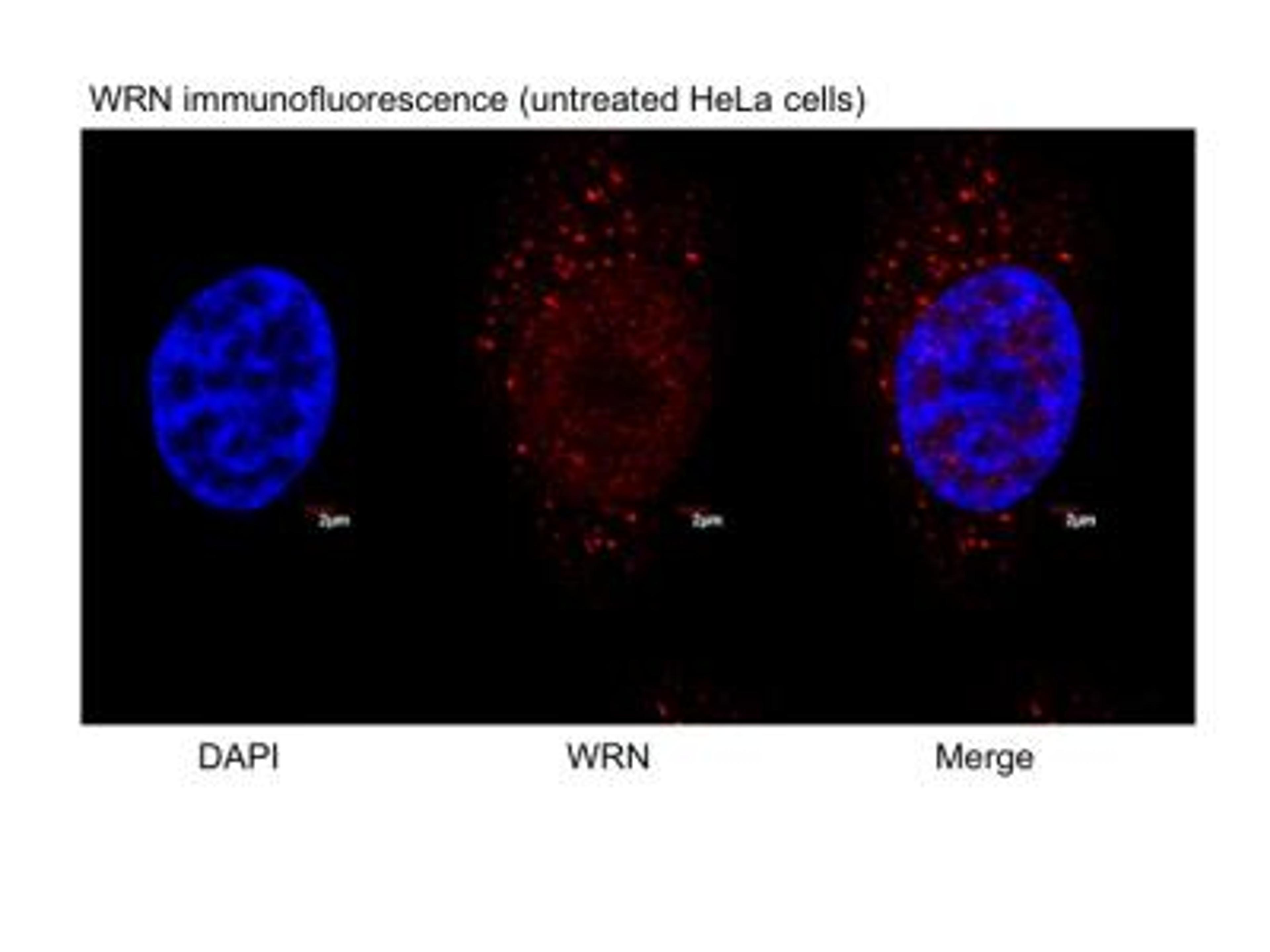 Immunocytochemistry/Immunofluorescence: WRN Antibody [NB100-471] - Analysis of WRN in untreated, asynchronous HeLa cells using anti-WRN antibody. The primary antibody was used at a dilution of 1:100, incubated for 1 hour at room temperature in 1XPBS. Image from verified customer review.