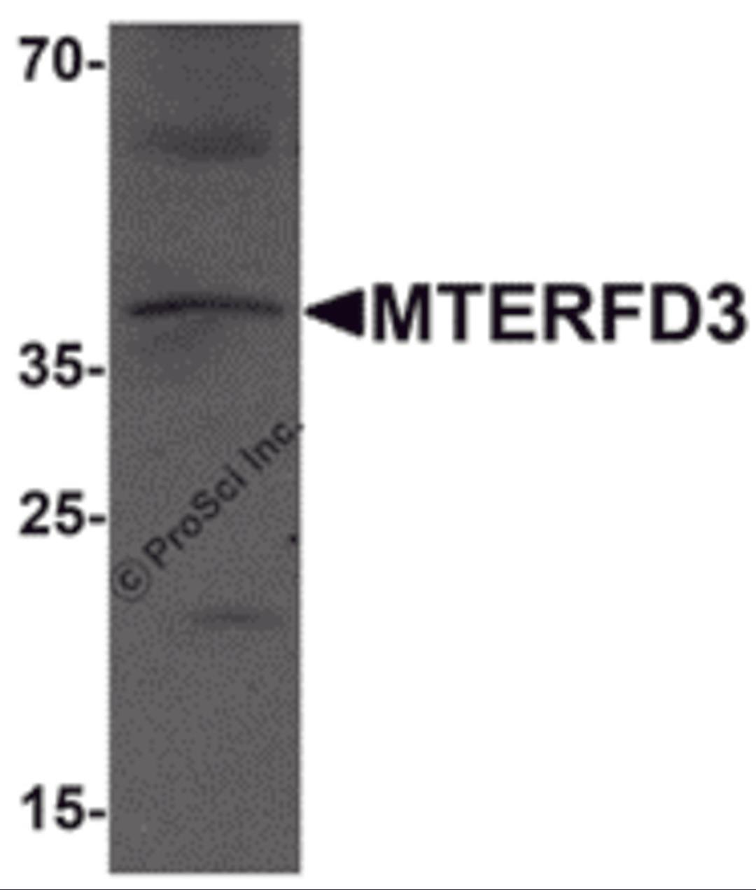 Western blot analysis of MTERFD3 in human testis tissue lysate with MTERFD3 antibody at 1 μg/mL.