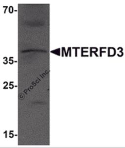 Western blot analysis of MTERFD3 in human testis tissue lysate with MTERFD3 antibody at 1 μg/mL.