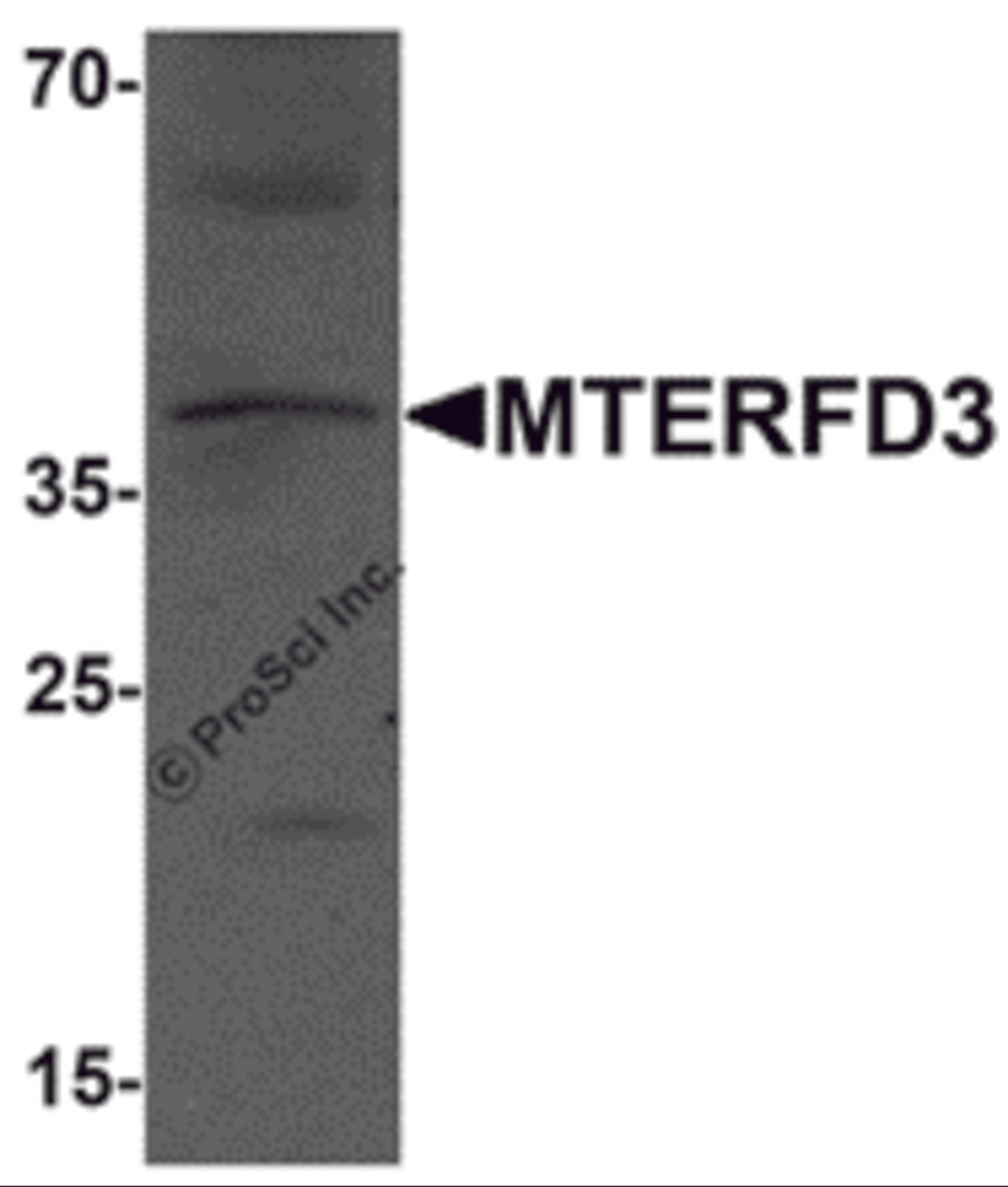 Western blot analysis of MTERFD3 in human testis tissue lysate with MTERFD3 antibody at 1 μg/mL.