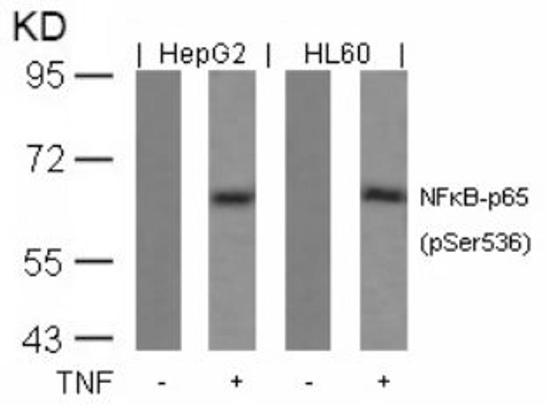 Western blot analysis of lysed extracts from HepG2 and HL60 cells untreated or treated with TNF using NFκB-p65 (Phospho-Ser536).