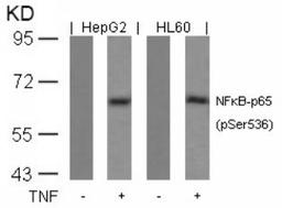 Western blot analysis of lysed extracts from HepG2 and HL60 cells untreated or treated with TNF using NFκB-p65 (Phospho-Ser536).