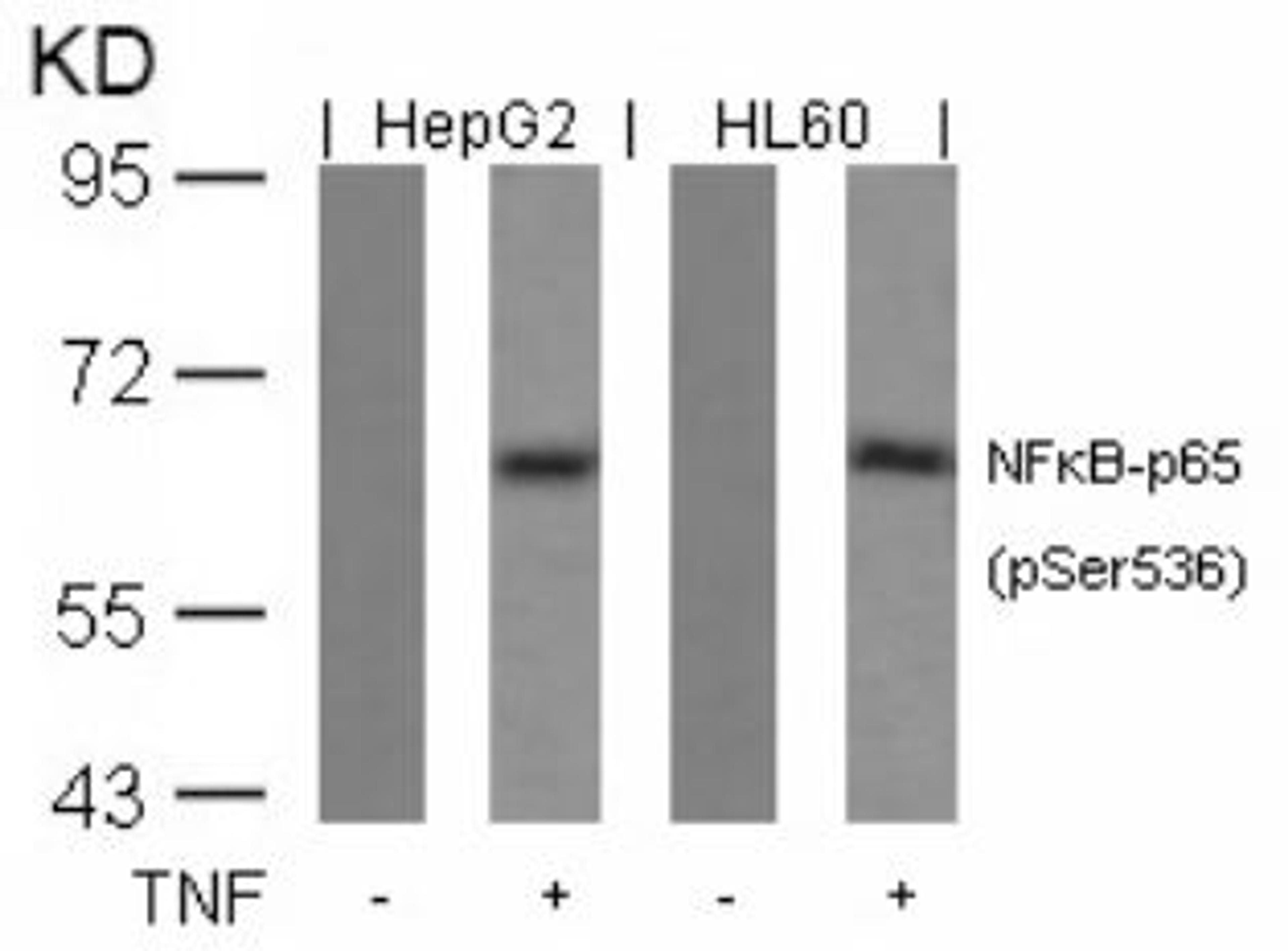 Western blot analysis of lysed extracts from HepG2 and HL60 cells untreated or treated with TNF using NFκB-p65 (Phospho-Ser536).