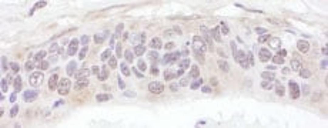 Detection of human UBXD1 by immunohistochemistry.