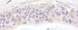 Detection of human UBXD1 by immunohistochemistry.