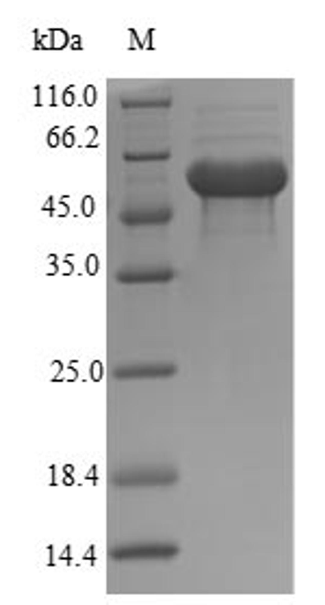(Tris-Glycine gel) Discontinuous SDS-PAGE (reduced) with 5% enrichment gel and 15% separation gel.