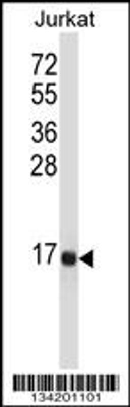 Western blot analysis in Jurkat cell line lysates (35ug/lane).