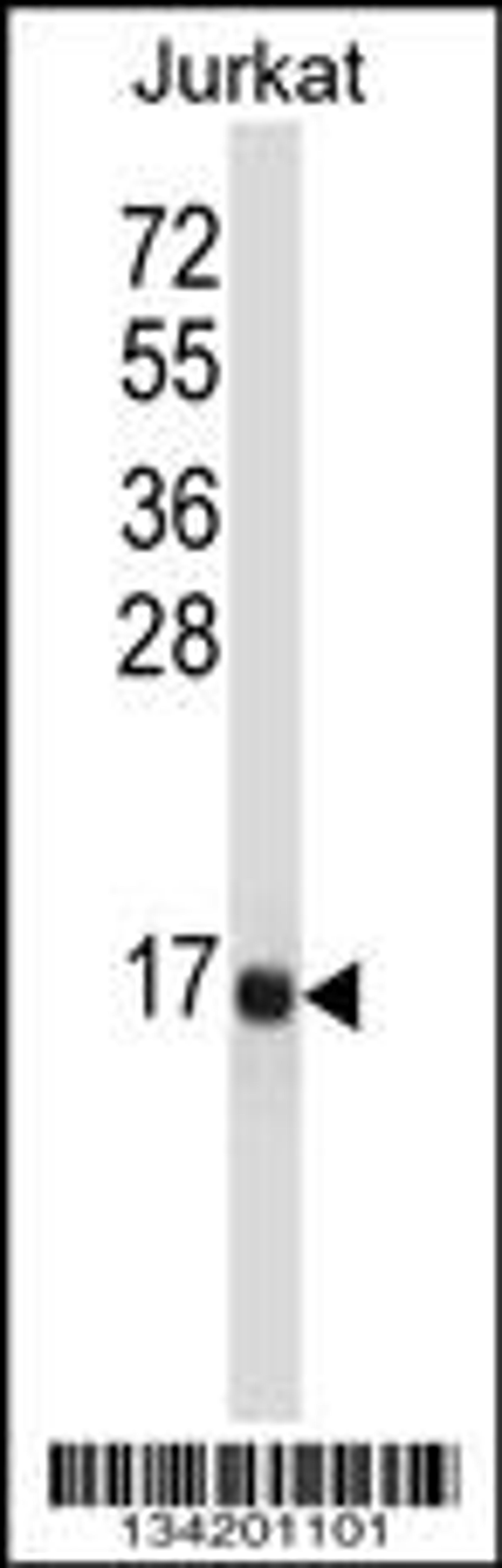 Western blot analysis in Jurkat cell line lysates (35ug/lane).