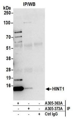 Detection of human HINT1 by western blot of immunoprecipitates.