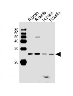 Western Blot at 1:1000 dilution Lane 1: rat brain lysates Lane 2: rat testis lysates Lane 3: human brain lysates Lane 4: human testis lysates Lysates/proteins at 20 ug per lane.