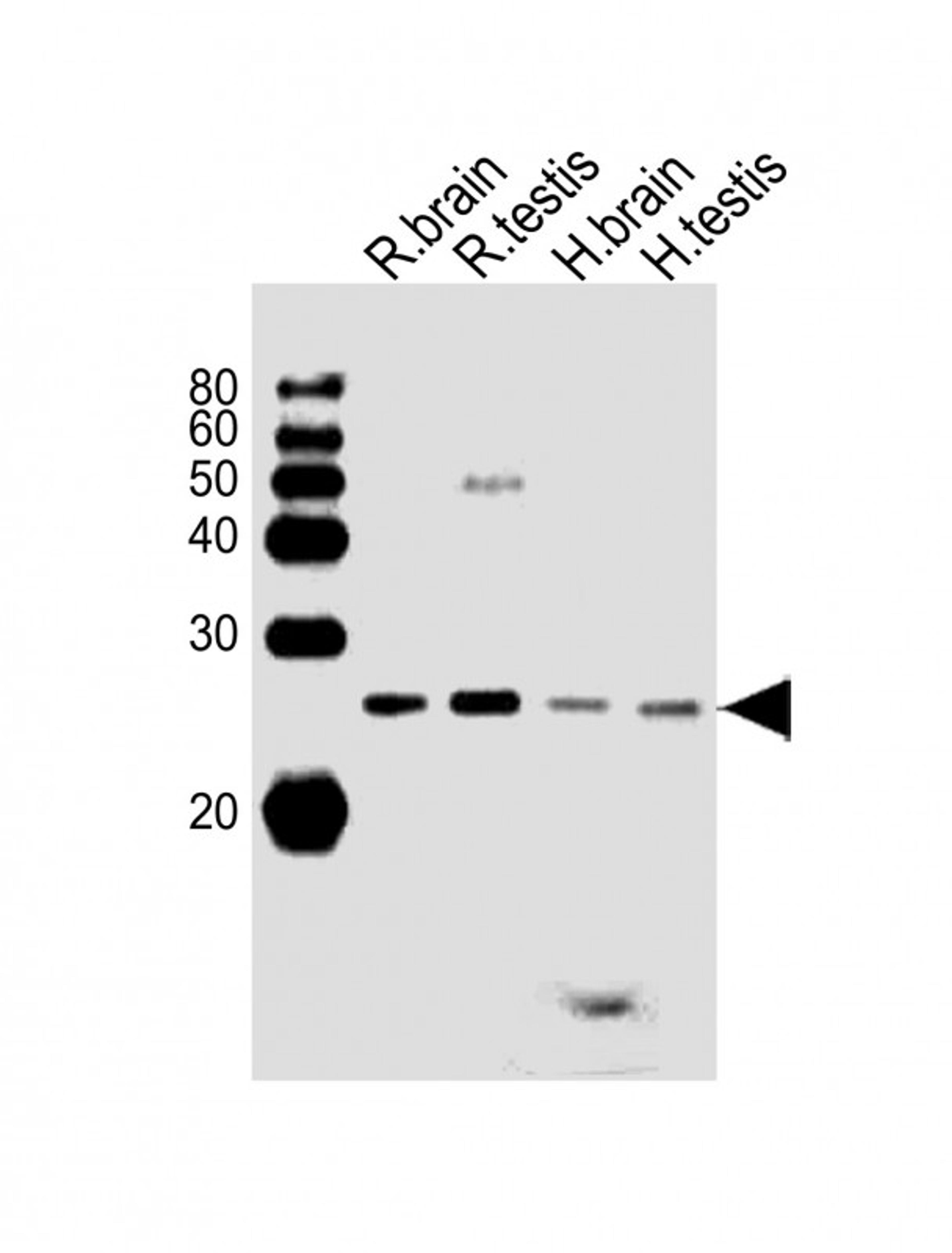 Western Blot at 1:1000 dilution Lane 1: rat brain lysates Lane 2: rat testis lysates Lane 3: human brain lysates Lane 4: human testis lysates Lysates/proteins at 20 ug per lane.