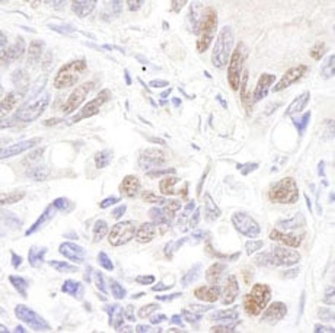 Detection of human p53 by immunohistochemistry.